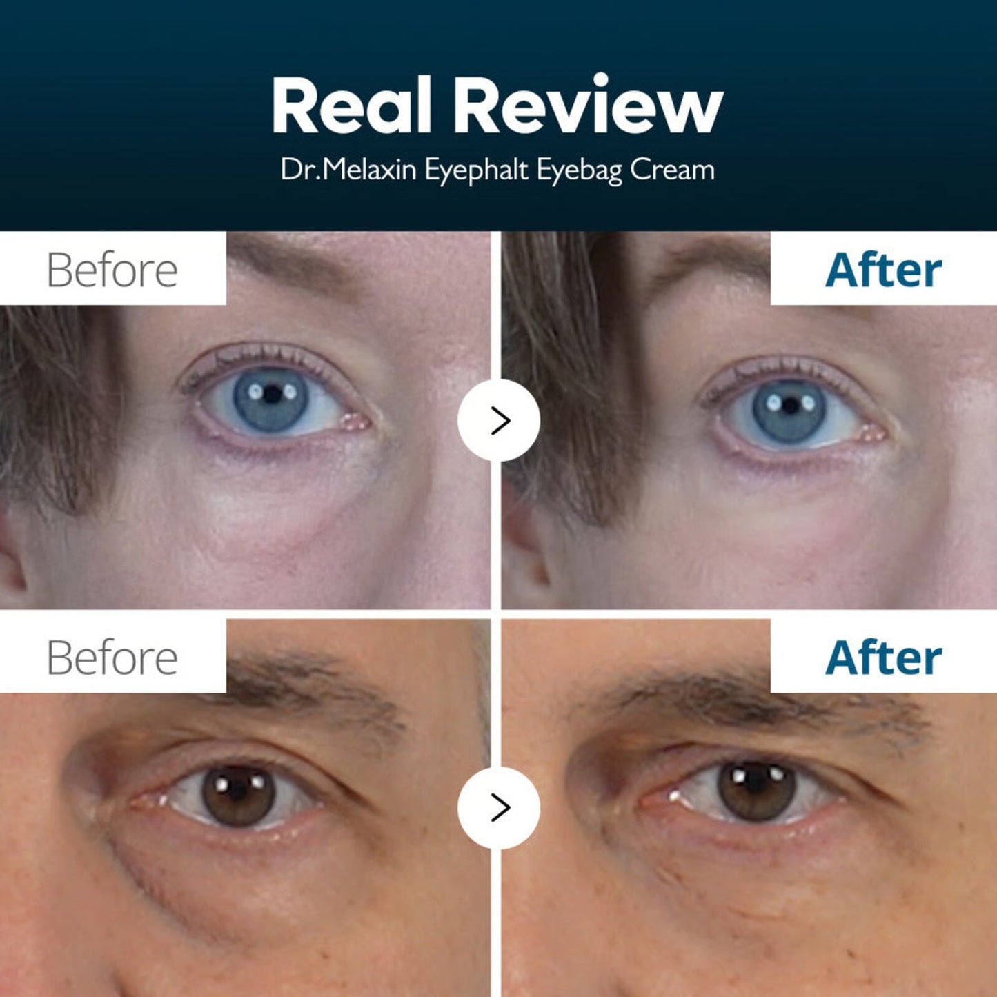 Dr.Melaxin Eyephalt Eyebag Cream 10g